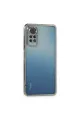 Xiaomi Redmi Note 11 Pro Kılıf Razer Lensli Silikon - Gümüş