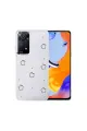 Xiaomi Redmi Note 11 Pro Fiyonk Desenli Kapak - Desen 2