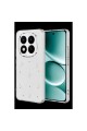 Xiaomi Redmi Note 15 4g Fiyonk Desenli Kapak - Desen 4